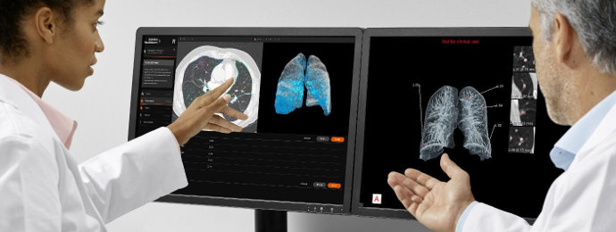 AstraZeneca: Der erste Verdoppler ist da